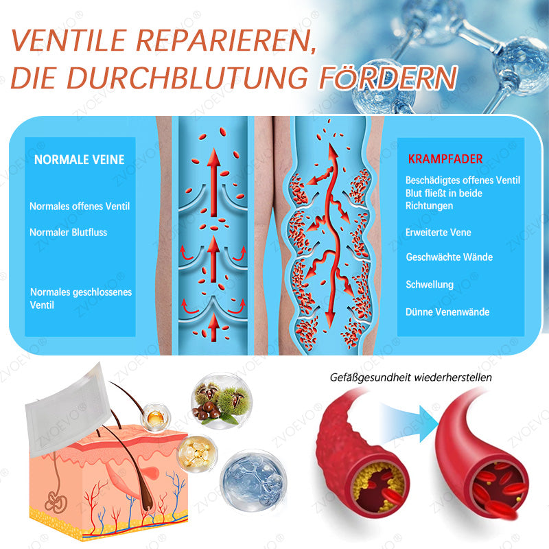 💐🎁Zvoevo® Vein Ease Mikronadel Pflegepflaster (Für Besenreiser, Krampfadern, Schwellungen & Beinermüdung)