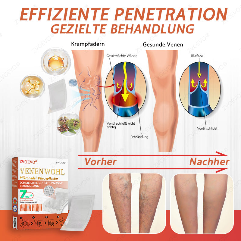 💐🎁Zvoevo® Vein Ease Mikronadel Pflegepflaster (Für Besenreiser, Krampfadern, Schwellungen & Beinermüdung)