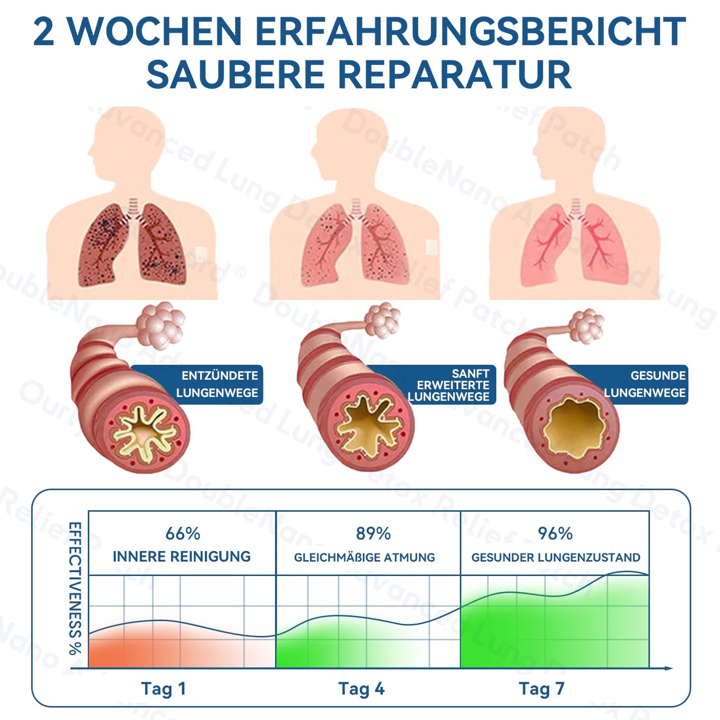 👨‍⚕️🏅BfArM-registriert | Zvoevo® DoubleNano COPD-Linderungspflaster (💝 Gezielte Behandlung bei Husten, Atemnot, Keuchen, Schleim, verstopfter Nase, Bronchitis, Allergiesymptomen und allgemeinen Lungenbeschwerden 🫁)
